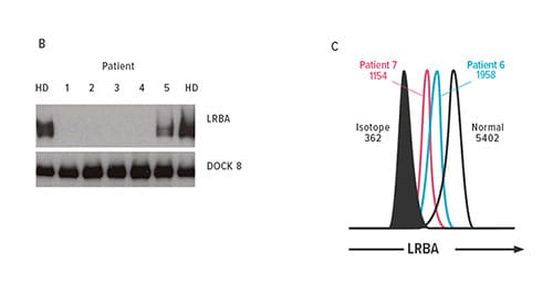 Fig. B-C. Immunoblotting for patients 1 to 5 and (C) flow cytometry for patients 6 and 7 show loss of LRBA compared with a healthy donor (HD). DOCK8 is included as a loading control.